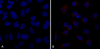 VPS35 Antibody: Biotin
