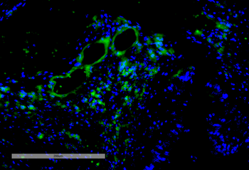 VPS35 Antibody
