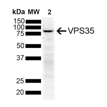 VPS35 Antibody (Biotin)
