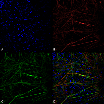 Tau Antibody (Biotin)
