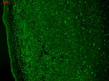 Cav3.2 Antibody