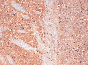 Cav3.2 Antibody