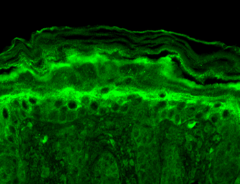 Slo2.2 Antibody