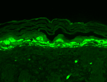 SHANK1 Antibody