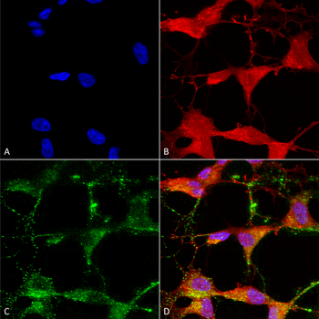 TRPV3 Antibody