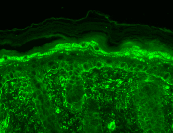 TRPV3 Antibody