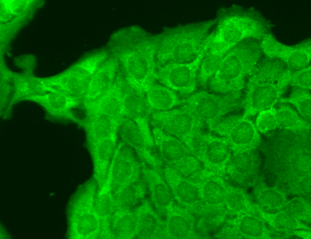 Nav1.8 Antibody