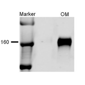 NKCC2 Antibody