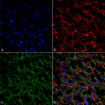 ENaC alpha Antibody