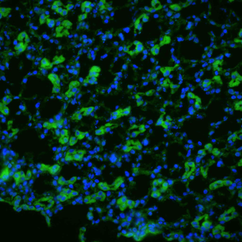 Aquaporin 1 Antibody