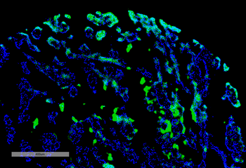 Thymidine Glycol Antibody (APC)