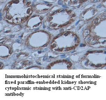 CD2AP Rabbit Polyclonal Antibody