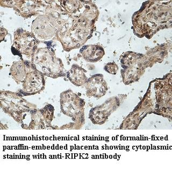 RIPK2 Rabbit Polyclonal Antibody