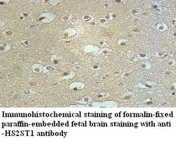HS2ST1 Rabbit Polyclonal Antibody
