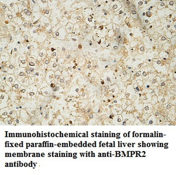 BMPR2 Rabbit Polyclonal Antibody