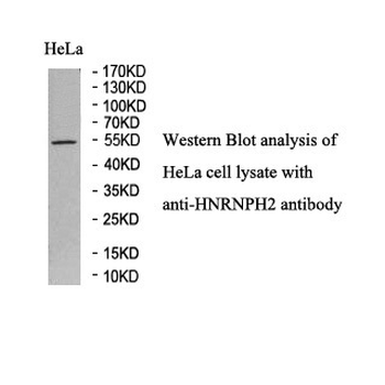 HNRNPH2 Rabbit Polyclonal Antibody