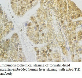 FTH1 Rabbit Polyclonal Antibody