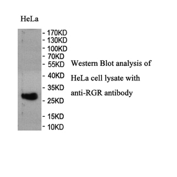 RGR Rabbit Polyclonal Antibody
