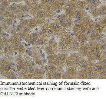 GALNT9 Rabbit Polyclonal Antibody