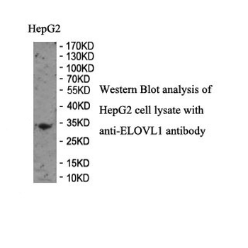ELOVL1 Rabbit Polyclonal Antibody