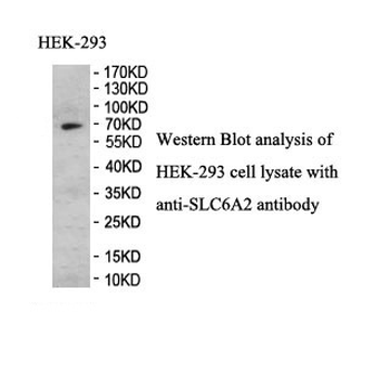 SLC6A2 Rabbit Polyclonal Antibody
