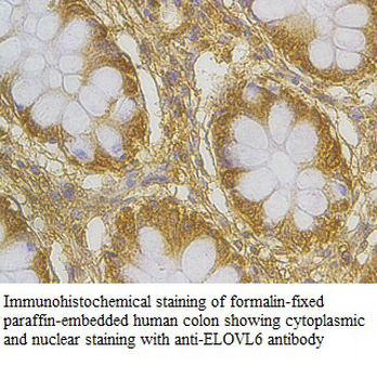 ELOVL6 Rabbit Polyclonal Antibody