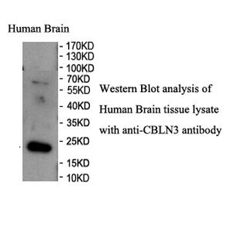 CBLN3 Rabbit Polyclonal Antibody