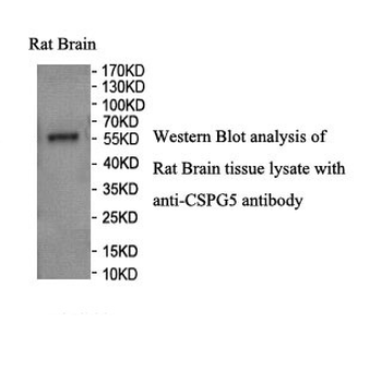 CSPG5 Rabbit Polyclonal Antibody