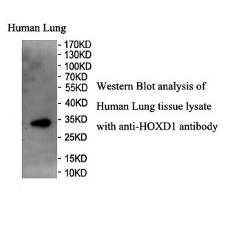 HOXD1 Rabbit Polyclonal Antibody