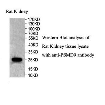 PSMD9 Rabbit Polyclonal Antibody