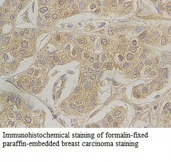 GBA Rabbit Polyclonal Antibody