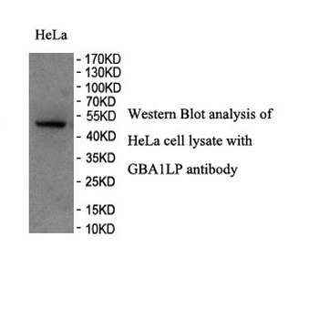 GBA Rabbit Polyclonal Antibody