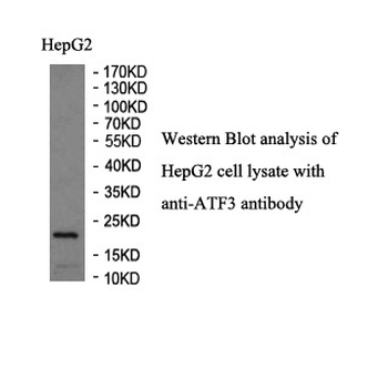ATF3 Rabbit Polyclonal Antibody
