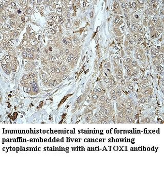 ATOX1 Rabbit Polyclonal Antibody