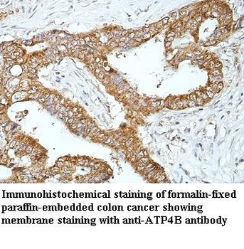 ATP4B Rabbit Polyclonal Antibody