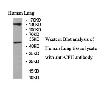 CFH Rabbit Polyclonal Antibody