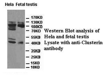 Clusterin Rabbit Polyclonal Antibody