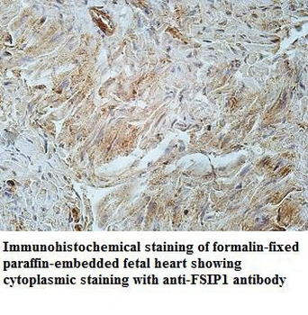 FSIP1 Rabbit Polyclonal Antibody