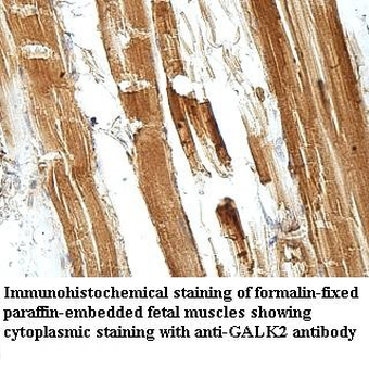 GALK2 Rabbit Polyclonal Antibody