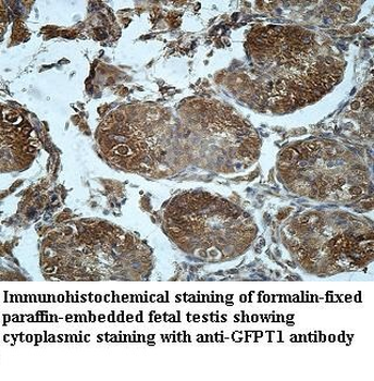 GFPT1 Rabbit Polyclonal Antibody