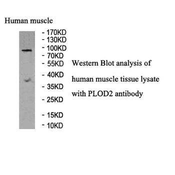 PLOD2 Rabbit Polyclonal Antibody