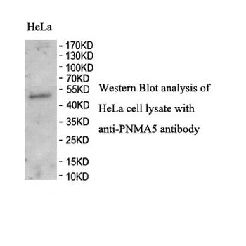 PNMA5 Rabbit Polyclonal Antibody