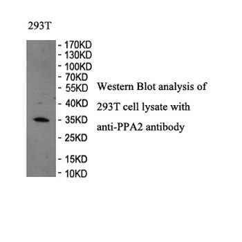PPA2 Rabbit Polyclonal Antibody