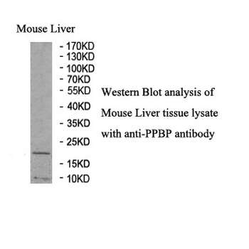 PPBP Rabbit Polyclonal Antibody