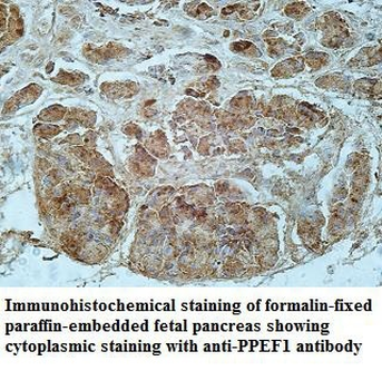 PPEF1 Rabbit Polyclonal Antibody