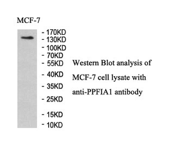 PPFIA1 Rabbit Polyclonal Antibody