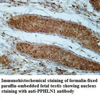 PPHLN1 Rabbit Polyclonal Antibody
