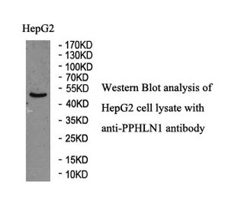 PPHLN1 Rabbit Polyclonal Antibody