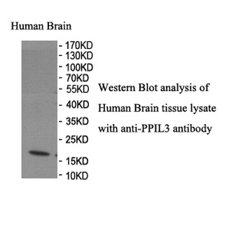 PPIL3 Rabbit Polyclonal Antibody