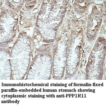 PPP1R11 Rabbit Polyclonal Antibody